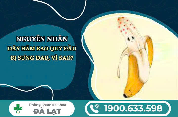 Hình ảnh minh họa